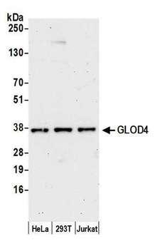 HC71 / GLOD4 Antibody - Detection of human GLOD4 by western blot. Samples: Whole cell lysate (15 µg) from HeLa, HEK293T, and Jurkat cells prepared using NETN lysis buffer. Antibody: Affinity purified rabbit anti-GLOD4 antibody used for WB at 1:1000. Detection: Chemiluminescence with an exposure time of 75 seconds.