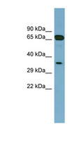 HC71 / GLOD4 Antibody - GLOD4 antibody Western blot of Placenta lysate. This image was taken for the unconjugated form of this product. Other forms have not been tested.