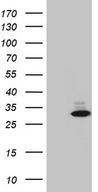 HCA557B / METTL21A Antibody - HEK293T cells were transfected with the pCMV6-ENTRY control. (Left lane) or pCMV6-ENTRY METTL21A. (Right lane) cDNA for 48 hrs and lysed. Equivalent amounts of cell lysates. (5 ug per lane) were separated by SDS-PAGE and immunoblotted with anti-METTL21A. (1:2000)