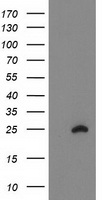 HCA557B / METTL21A Antibody - HEK293T cells were transfected with the pCMV6-ENTRY control (Left lane) or pCMV6-ENTRY FAM119A (Right lane) cDNA for 48 hrs and lysed. Equivalent amounts of cell lysates (5 ug per lane) were separated by SDS-PAGE and immunoblotted with anti-FAM119A.