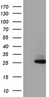 HCA557B / METTL21A Antibody - HEK293T cells were transfected with the pCMV6-ENTRY control. (Left lane) or pCMV6-ENTRY METTL21A. (Right lane) cDNA for 48 hrs and lysed
