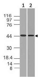 HCAR3 / GPR109B / HM74 Antibody - Fig-1: Western blot analysis of HCAR3. Anti-HCAR3 antibody was used at 2 µg/ml on MOLT-4 lysate.