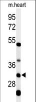 HCCS Antibody - Western blot of HCCS Antibody in mouse heart tissue lysates (35 ug/lane). HCCS (arrow) was detected using the purified antibody.