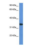 HCCS Antibody - HCCS antibody Western blot of HepG2 Cell lysate. Antibody concentration 1 ug/ml.  This image was taken for the unconjugated form of this product. Other forms have not been tested.