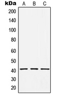 HCCS Antibody - Western blot analysis of HCCS expression in HepG2 (A); Raw264.7 (B); rat kidney (C) whole cell lysates.
