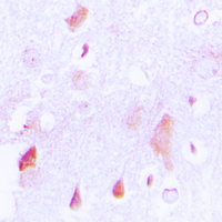 HCCS Antibody - Immunohistochemical analysis of HCCS staining in human brain formalin fixed paraffin embedded tissue section. The section was pre-treated using heat mediated antigen retrieval with sodium citrate buffer (pH 6.0). The section was then incubated with the antibody at room temperature and detected using an HRP conjugated compact polymer system. DAB was used as the chromogen. The section was then counterstained with hematoxylin and mounted with DPX.