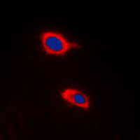 HCCS Antibody - Immunofluorescent analysis of HCCS staining in Raw264.7 cells. Formalin-fixed cells were permeabilized with 0.1% Triton X-100 in TBS for 5-10 minutes and blocked with 3% BSA-PBS for 30 minutes at room temperature. Cells were probed with the primary antibody in 3% BSA-PBS and incubated overnight at 4 C in a humidified chamber. Cells were washed with PBST and incubated with a DyLight 594-conjugated secondary antibody (red) in PBS at room temperature in the dark. DAPI was used to stain the cell nuclei (blue).