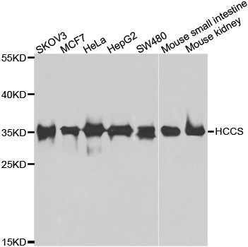 HCCS Antibody - Western blot analysis of extracts of various cell lines.