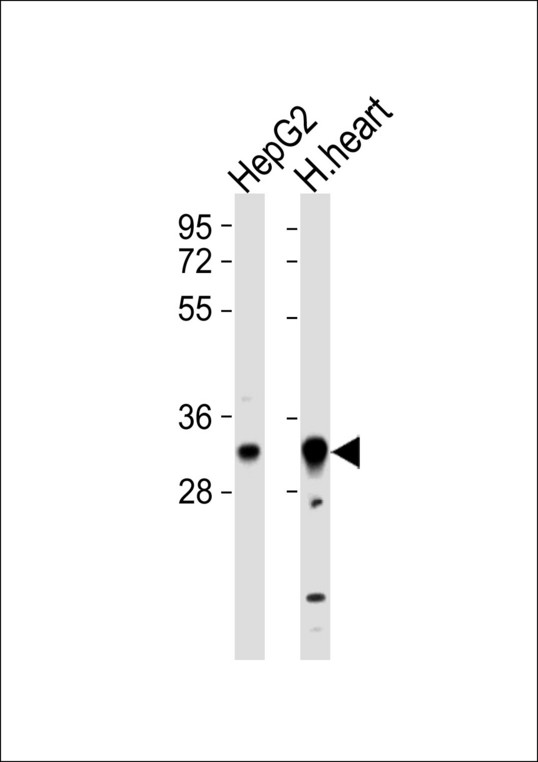 HCCS Antibody - All lanes : Anti-HCCS Antibody at 1:1000 dilution Lane 1: HepG2 whole cell lysates Lane 2: human heart lysates Lysates/proteins at 20 ug per lane. Secondary Goat Anti-Rabbit IgG, (H+L),Peroxidase conjugated at 1/10000 dilution Predicted band size : 31 kDa Blocking/Dilution buffer: 5% NFDM/TBST.