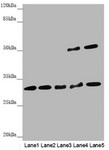 HCCS Antibody - Western blot All Lanes: HCCS antibody at 2.05 ug/ml Lane 1: Mouse heart tissue Lane 2: Hela whole cell lysate Lane 3: Raw264.7 whole cell lysate Lane 4: MCF7 whole cell lysate Lane 5: HepG-2 whole cell lysate Secondary Goat polyclonal to rabbit IgG at 1/10000 dilution Predicted band size: 31 kDa Observed band size: 31,50 kDa