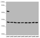 HCCS Antibody - Western blot All Lanes: HCCS antibody at 3.54 ug/ml Lane 1: Mouse small intestine tissue Lane 2: Human placenta tissue Lane 3: Mouse kidney tissue Lane 4: Mouse heart tissue Lane 5: Mouse skeletal muscle tissue Lane 6: Hela whole cell lysate Lane 7: Raw264.7 whole cell lysate Lane 8: MCF7 whole cell lysate Lane 9: HepG-2 whole cell lysate Secondary Goat polyclonal to rabbit IgG at 1/10000 dilution Predicted band size: 31 kDa Observed band size: 31,60 kDa