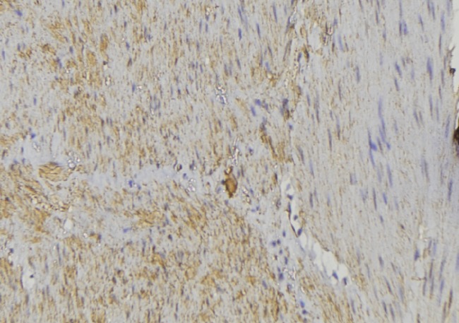 HCCS Antibody - 1:100 staining mouse muscle tissue by IHC-P. The sample was formaldehyde fixed and a heat mediated antigen retrieval step in citrate buffer was performed. The sample was then blocked and incubated with the antibody for 1.5 hours at 22°C. An HRP conjugated goat anti-rabbit antibody was used as the secondary.