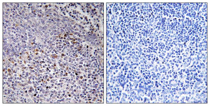 HCCS Antibody - Peptide - + Immunohistochemistry analysis of paraffin-embedded human tonsil tissue using Cytochrome c-type Heme Lyase antibody.