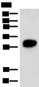 HCCS Antibody - Western blot analysis of HepG2 cell lysate  using HCCS Polyclonal Antibody at dilution of 1:4000