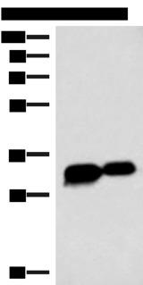 HCCS Antibody - Western blot analysis of HepG2 cell Mouse heart tissue lysates  using HCCS Polyclonal Antibody at dilution of 1:4000