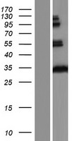 HCCS Protein - Western validation with an anti-DDK antibody * L: Control HEK293 lysate R: Over-expression lysate