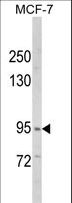 HCCS1 / VPS53 Antibody - Western blot of VPS53 Antibody in MCF-7 cell line lysates (35 ug/lane). VPS53 (arrow) was detected using the purified antibody.