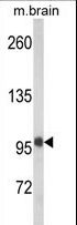 HCCS1 / VPS53 Antibody - Western blot of VPS53 Antibody in mouse brain tissue lysates (35 ug/lane). VPS53 (arrow) was detected using the purified antibody.