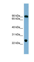 HCCS1 / VPS53 Antibody - VPS53 antibody Western blot of Fetal Muscle lysate. This image was taken for the unconjugated form of this product. Other forms have not been tested.