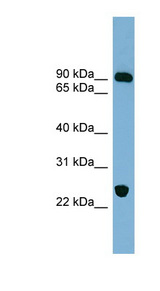 HCCS1 / VPS53 Antibody - VPS53 antibody Western blot of Fetal Muscle lysate. This image was taken for the unconjugated form of this product. Other forms have not been tested.