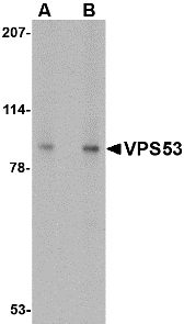 HCCS1 / VPS53 Antibody - Western blot of VPS53 in 293 cell lysate with VPS53 antibody at (A) 0.5 and (B) 1 ug/ml.