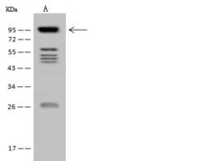 HCCS1 / VPS53 Antibody - Anti-VPS53 rabbit polyclonal antibody at 1:500 dilution. Lane A: U-251 MG Whole Cell Lysate. Lysates/proteins at 30 ug per lane. Secondary: Goat Anti-Rabbit IgG (H+L)/HRP at 1/10000 dilution. Developed using the ECL technique. Performed under reducing conditions. Predicted band size: 80 kDa. Observed band size: 95 kDa.