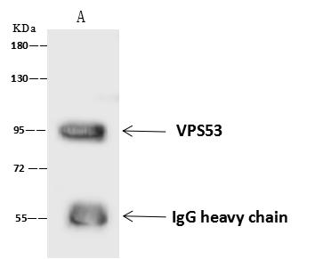 HCCS1 / VPS53 Antibody - VPS53 was immunoprecipitated using: Lane A: 0.5 mg U-251 MG Whole Cell Lysate. 4 uL anti-VPS53 rabbit polyclonal antibody and 60 ug of Immunomagnetic beads Protein A/G. Primary antibody: Anti-VPS53 rabbit polyclonal antibody, at 1:100 dilution. Secondary antibody: Goat Anti-Rabbit IgG (H+L)/HRP at 1/10000 dilution. Developed using the ECL technique. Performed under reducing conditions. Predicted band size: 80 kDa. Observed band size: 95 kDa.