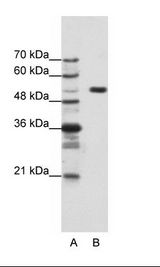 HCF1 / HCFC1 Antibody - A: Marker, B: HepG2 Cell Lysate.  This image was taken for the unconjugated form of this product. Other forms have not been tested.