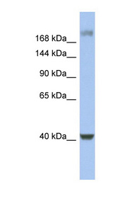 HCF1 / HCFC1 Antibody - HCFC1 / HCF-1 antibody Western blot of Fetal Stomach lysate. This image was taken for the unconjugated form of this product. Other forms have not been tested.