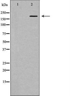 HCF1 / HCFC1 Antibody - Western blot analysis of extracts of HEK293 cells using HCFC1 antibody. The lane on the left is treated with the antigen-specific peptide.