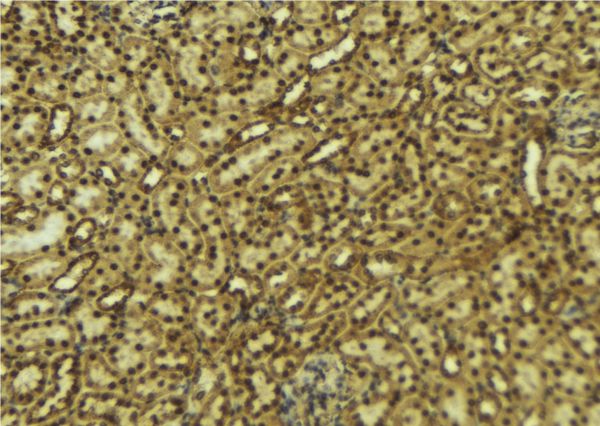 HCF1 / HCFC1 Antibody - 1:100 staining mouse kidney tissue by IHC-P. The sample was formaldehyde fixed and a heat mediated antigen retrieval step in citrate buffer was performed. The sample was then blocked and incubated with the antibody for 1.5 hours at 22°C. An HRP conjugated goat anti-rabbit antibody was used as the secondary.