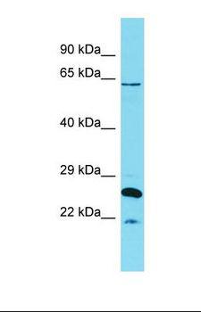 HCF1 / HCFC1 Antibody - Western blot of Human Uterus Tumor. HCFC1 antibody dilution 1.0 ug/ml.  This image was taken for the unconjugated form of this product. Other forms have not been tested.