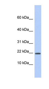 HCFC1R1 / HPIP Antibody - HCFC1R1 antibody Western blot of Fetal Spleen lysate. This image was taken for the unconjugated form of this product. Other forms have not been tested.