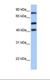 HCFC2 Antibody - Jurkat cell lysate. Antibody concentration: 1.0 ug/ml. Gel concentration: 12%.  This image was taken for the unconjugated form of this product. Other forms have not been tested.