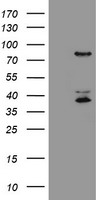 HCFC2 Antibody - HEK293T cells were transfected with the pCMV6-ENTRY control (Left lane) or pCMV6-ENTRY HCFC2 (Right lane) cDNA for 48 hrs and lysed. Equivalent amounts of cell lysates (5 ug per lane) were separated by SDS-PAGE and immunoblotted with anti-HCFC2.