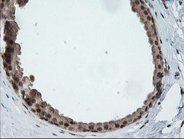 HCFC2 Antibody - IHC of paraffin-embedded Human breast tissue using anti-HCFC2 mouse monoclonal antibody.