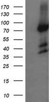 HCFC2 Antibody - HEK293T cells were transfected with the pCMV6-ENTRY control (Left lane) or pCMV6-ENTRY HCFC2 (Right lane) cDNA for 48 hrs and lysed. Equivalent amounts of cell lysates (5 ug per lane) were separated by SDS-PAGE and immunoblotted with anti-HCFC2.