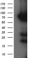 HCFC2 Antibody - HEK293T cells were transfected with the pCMV6-ENTRY control (Left lane) or pCMV6-ENTRY HCFC2 (Right lane) cDNA for 48 hrs and lysed. Equivalent amounts of cell lysates (5 ug per lane) were separated by SDS-PAGE and immunoblotted with anti-HCFC2.