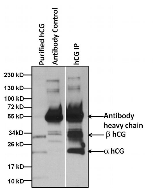 hCG / Chorionic Gonadotropin Antibody - Immunoprecipitation of hCG proteins was performed by spiking 5 ugs of purified hCG protein extracted from human urine into 1ml of 1:2 diluted human urine sample. Antigen-antibody complexes were formed by incubating with 5ug of hCG antibody overnight on end over end tube rotator at 4C. The immune complexes were captured by using 50ul Protein A/G Agarose, washed extensively, and eluted with Lane Marker Reducing Sample Buffer. Samples were resolved on a 4-20% Tris-HCl polyacrylamide gel, transferred to a PVDF membrane, and blocked with 5% milk for at least 1 hour at room temperature. hCG was detected at ~32 and 22 kD using hCG monoclonal antibody at a concentration of 4 µg/mL in blocking buffer overnight at 4C on a rocking platform, followed by an HRP-conjugated goat anti-mouse IgG (Fc) secondary antibody at a dilution of 1:10,000 for at least 1 hour. Chemiluminescent detection was performed using SuperSignal West Dura.