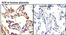 hCG / Chorionic Gonadotropin Antibody - Immunohistochemistry analysis of hCG was performed on human placenta tissue and is showing positive staining in extra cellular spaces. To expose target proteins, antigen retrieval was performed by microwaving tissues for 20 minutes in 10mM sodium citrate buffer (pH 6.0). Tissue slides were probed with hCG monoclonal antibody at a dilution of 1:20, overnight at 4C in a humidified chamber without (left panel) or with hCG antibody control (right panel). Tissues were washed, and incubated with secondary antibody (conjugated with HRP) for 30 min at room temperature in a humidified chamber. Detection was performed using DAB substrate kit. Tissues were counterstained with hematoxylin and dehydrated to prep for mounting. Images were taken at 20x magnification.