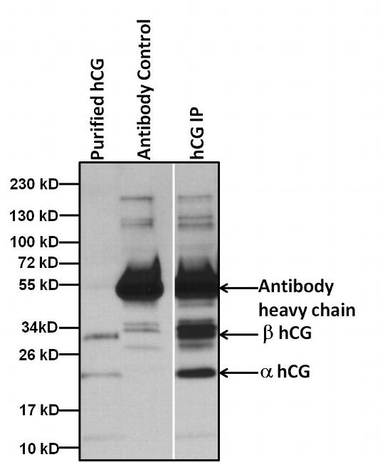 hCG / Chorionic Gonadotropin Antibody - Immunoprecipitation of hCG proteins was performed by spiking 5 ugs of purified hCG protein extracted from human urine into 1ml of 1:2 diluted human urine sample. Antigen-antibody complexes were formed by incubating with 5ug of hCG antibody overnight on end over end tube rotator at 4C. The immune complexes were captured by using 50ul Protein A/G Agarose, washed extensively, and eluted with Lane Marker Reducing Sample Buffer. Samples were resolved on a 4-20% Tris-HCl polyacrylamide gel, transferred to a PVDF membrane, and blocked with 5% milk for at least 1 hour at room temperature. hCG was detected at ~32 and 22 kD using hCG monoclonal antibody at a concentration of 4 µg/mL in blocking buffer overnight at 4C on a rocking platform, followed by an HRP-conjugated goat anti-mouse IgG (Fc) secondary antibody at a dilution of 1:10,000 for at least 1 hour. Chemiluminescent detection was performed using SuperSignal West Dura.