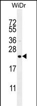 hCG_1657980 Antibody - hCG_1657980 Antibody (Center) western blot analysis in WiDr cell line lysates (35ug/lane).This demonstrates the hCG_1657980 antibody detected the hCG_1657980 protein (arrow).