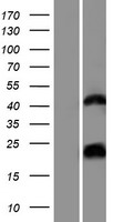 hCG_1657980 Protein - Western validation with an anti-DDK antibody * L: Control HEK293 lysate R: Over-expression lysate