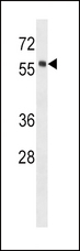 HCK Antibody - HCK Antibody (E8) western blot of human placenta tissue lysates (35 ug/lane). The HCK antibody detected the HCK protein (arrow).