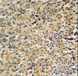 HCK Antibody - HCK Antibody immunohistochemistry of formalin-fixed and paraffin-embedded human spleen tissue followed by peroxidase-conjugated secondary antibody and DAB staining.