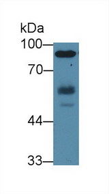 HCK Antibody - Western Blot; Sample: Human Jurkat cell lysate; Primary Ab: 2µg/ml Rabbit Anti-Human HCK Antibody Second Ab: 0.2µg/mL HRP-Linked Caprine Anti-Rabbit IgG Polyclonal Antibody