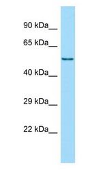 HCK Antibody - HCK antibody Western Blot of Fetal Thymus.  This image was taken for the unconjugated form of this product. Other forms have not been tested.