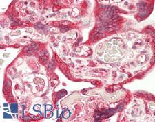 HCK Antibody - Human Placenta: Formalin-Fixed, Paraffin-Embedded (FFPE)