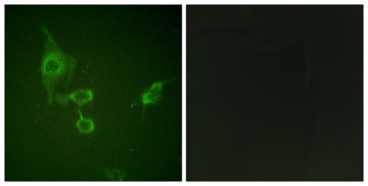 HCK Antibody - Immunofluorescence analysis of HepG2 cells, using HCK Antibody. The picture on the right is blocked with the synthesized peptide.