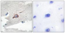 HCK Antibody - Immunohistochemistry analysis of paraffin-embedded human brain tissue, using HCK Antibody Antibody. The picture on the right is blocked with the synthesized peptide.